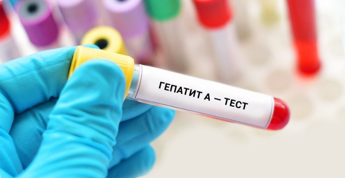 Медики розслідують спалах гепатиту А у Києві